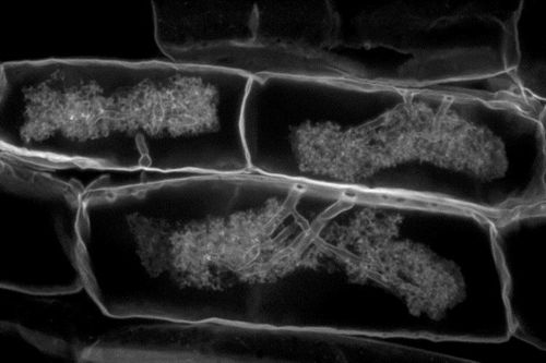 Here we see arbuscular mycorrhizal fungi penetrating into the cells of a root. Courtesy of Larry Petersen, University of Guelph